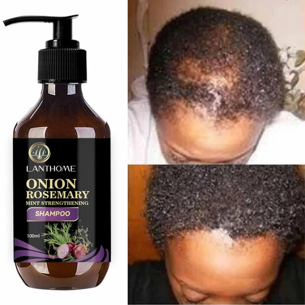 Rosemary Onion Hair Growth Shampoo – Fast Results in 7 Days