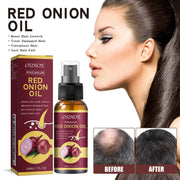 Red Onion Hair Growth Spray – Prevent Hair Loss & Nourish Roots