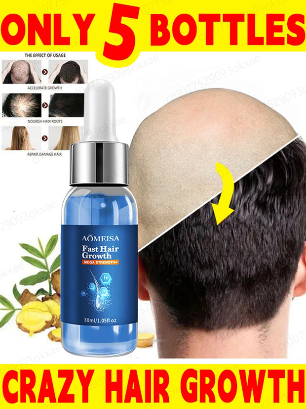 AOMEISA Hair Growth Serum  Strengthen Roots, Reduce Hair Loss & Boost Regrowth