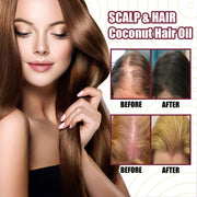 Red Onion Hair Growth Spray – Prevent Hair Loss & Nourish Roots