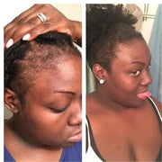 Rosemary Onion Hair Growth Shampoo – Fast Results in 7 Days