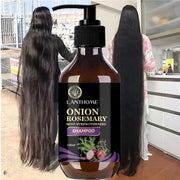 Rosemary Onion Hair Growth Shampoo – Fast Results in 7 Days