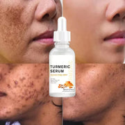 Bestselling Turmeric Dark Spot Corrector Serum