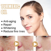 Bestselling Turmeric Dark Spot Corrector Serum