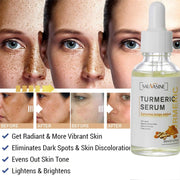 Bestselling Turmeric Dark Spot Corrector Serum