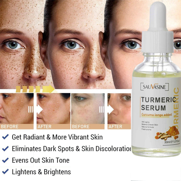 Bestselling Turmeric Dark Spot Corrector Serum