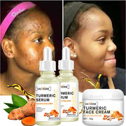 Bestselling Turmeric Dark Spot Corrector Serum