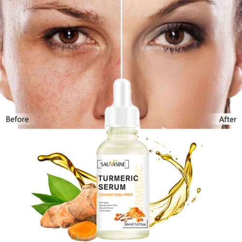 Bestselling Turmeric Dark Spot Corrector Serum