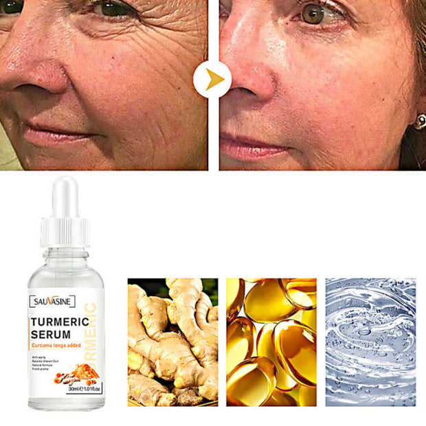 Bestselling Turmeric Dark Spot Corrector Serum